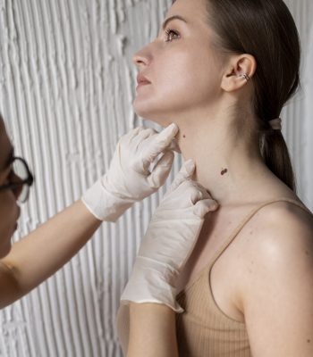doctora-diagnosticando-melanoma-cuerpo-paciente-1-scaled.jpg