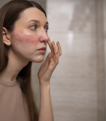 dermatóloga especialista en acné